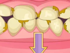 Mäng Bad Teeth Makeover Internetis