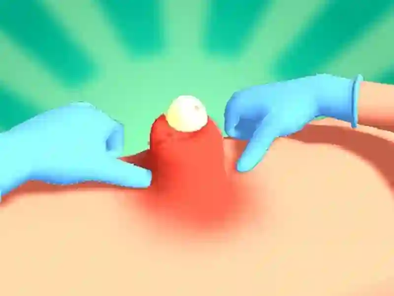 Mäng Pimple Squeeze Internetis